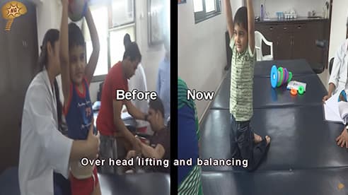 Diyan Jain, cell therapy Success Story, Neurogenbsi Patients