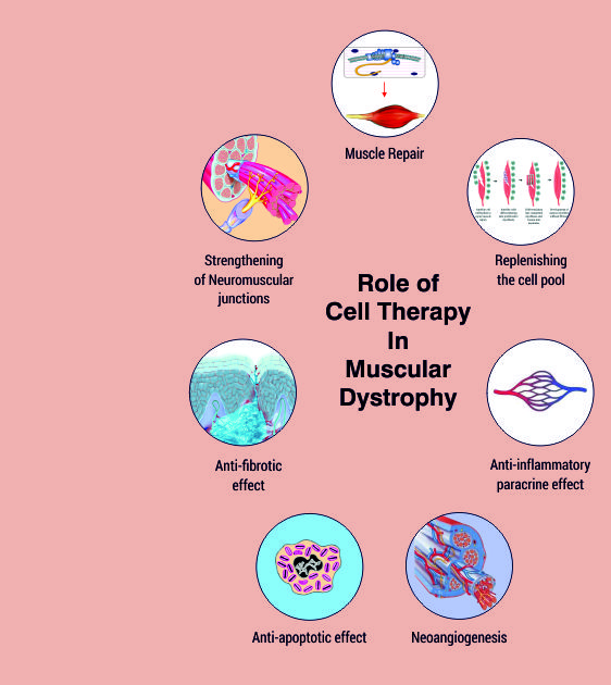 Muscular Dystrophy Causes