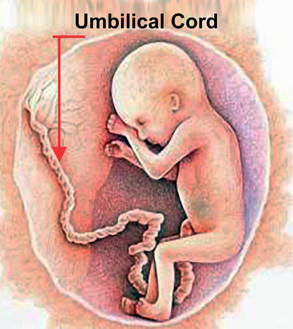 Umbilical Stem Cell