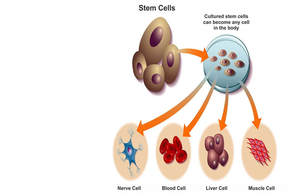 What Are Stem Cells